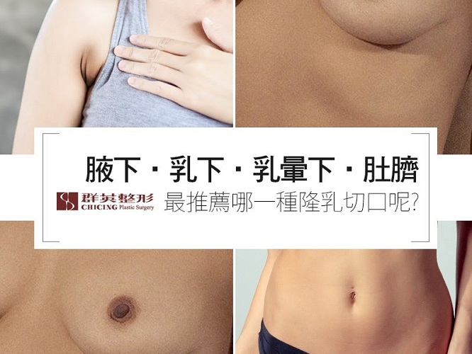 群英林雍球醫師_隆乳文章102102