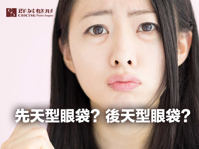 群英姚勝發醫師_開眼袋文章102103