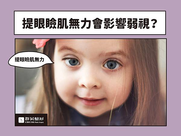 群英陳歷舜醫師_提眼瞼肌手術文章102103