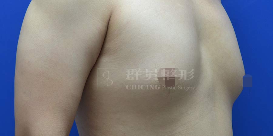 Before-03