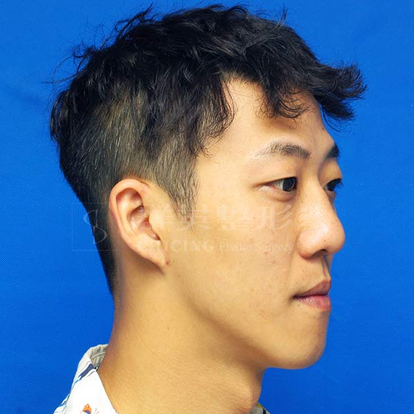 Before-CASE02-2