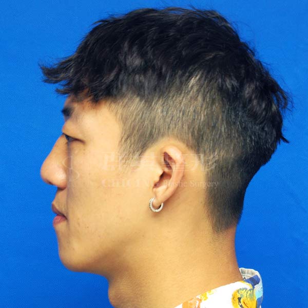 Before-CASE02-3