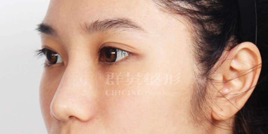 Before-02