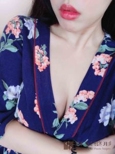 陳廣得醫師_魔滴隆乳案例