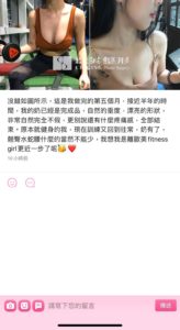 陳廣得醫師_魔滴隆乳案例