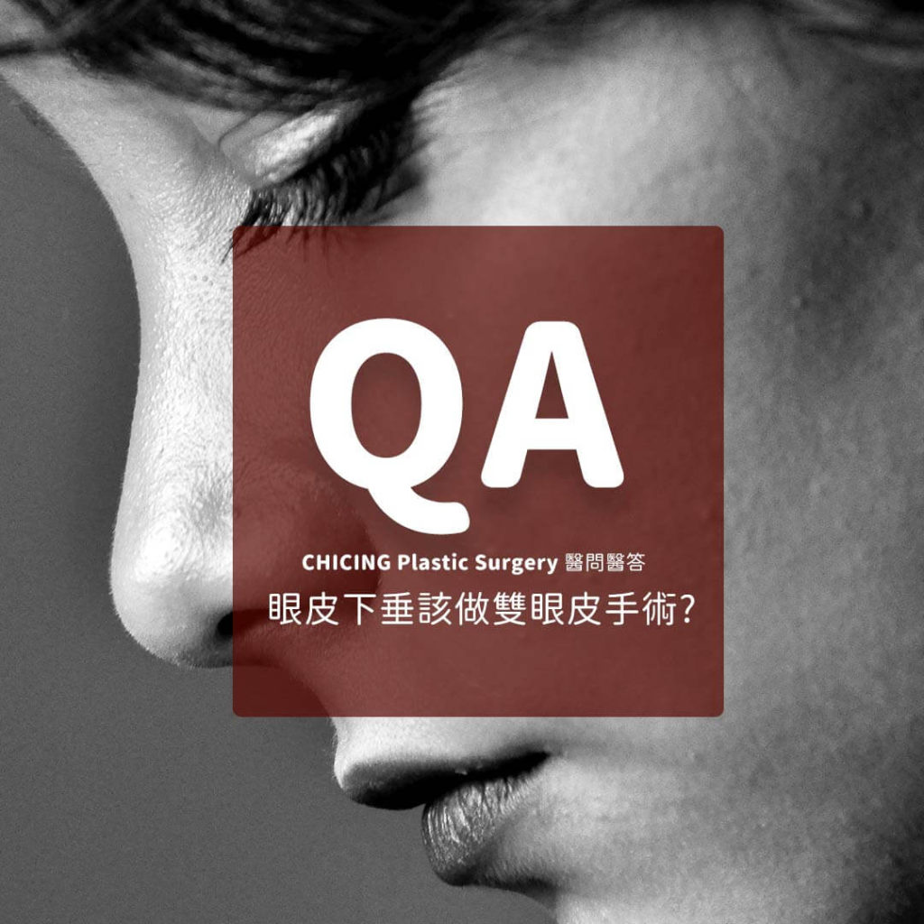 眼皮下垂_張世幸醫師