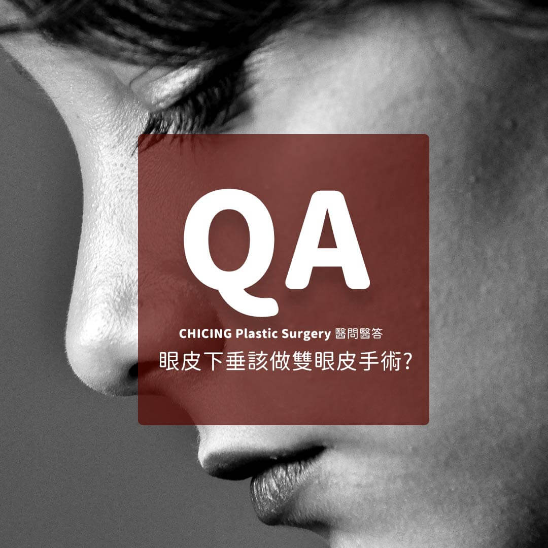 眼皮下垂_張世幸醫師