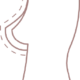 1Bre4ast-Implant-RevisionBanner