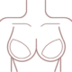 1Breast-Implant-R5evisionBanner