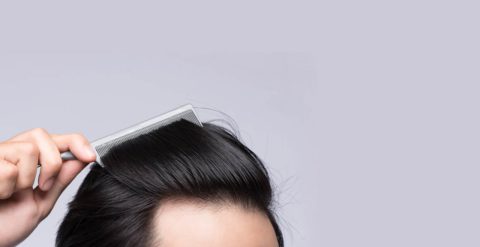 hairtransplants_03