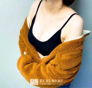 陳廣得醫師_魔滴隆乳案例