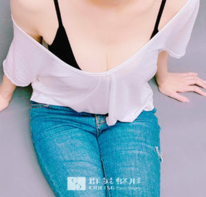 陳廣得醫師_魔滴隆乳案例