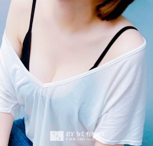 陳廣得醫師_魔滴隆乳案例